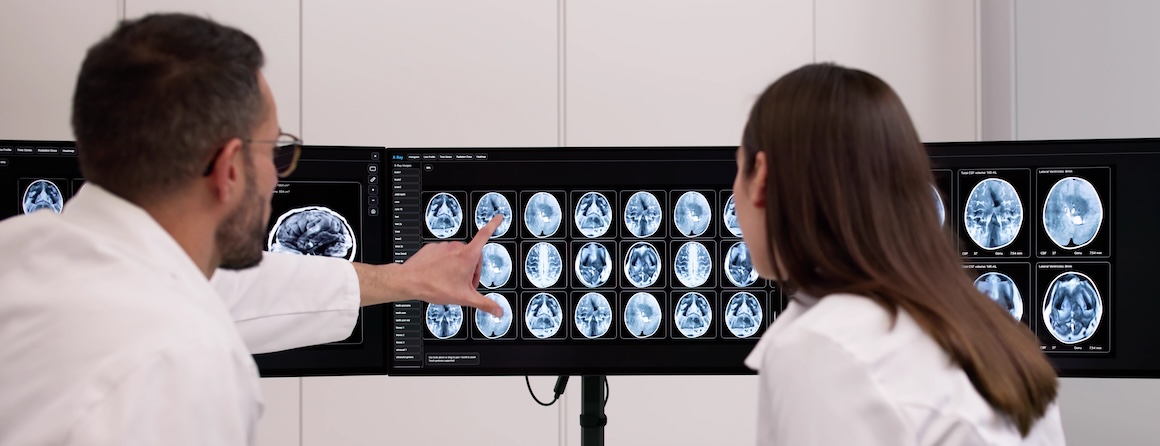 Two researchers looking at epilepsy data and brain scans on a computer