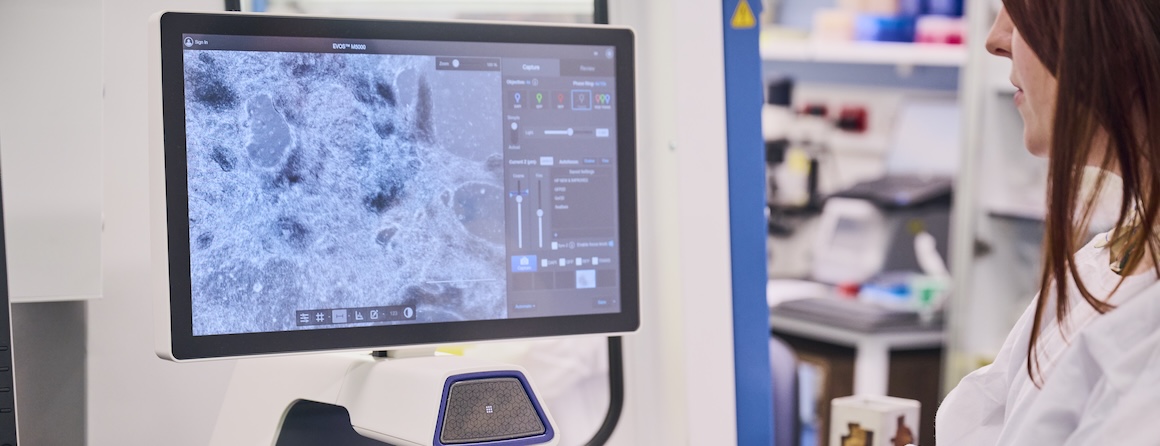 Researcher looking at stem cells on screen