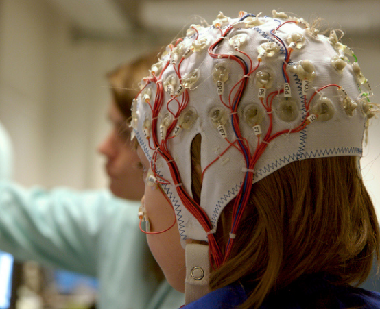 Doctors does an EEG scan on female child 