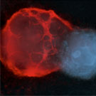 Confocal image related to blood disease research