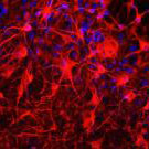 Confocal image related to brain research