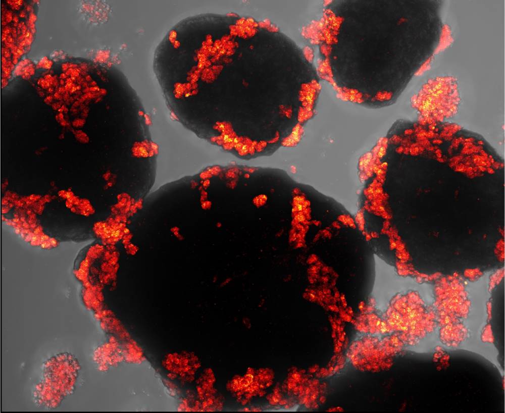 crown of thorns - iHSC cells by Hasindu Edirisinghe