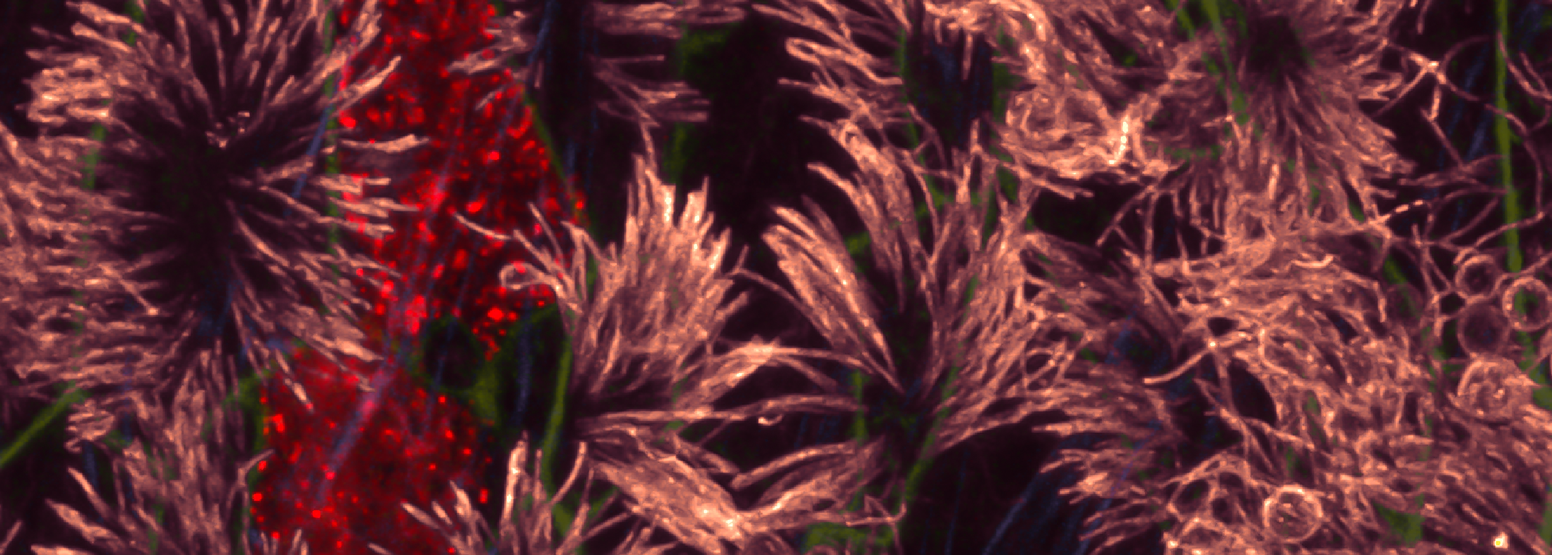 Stem cell-derived lung cells. Photo courtesy of Dr Declan Turner, Postdoctoral Researcher, Lung Disease group.
